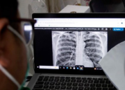 Pemerintah Perkuat Strategi Eliminasi TBC 2030, Fokus pada Perlindungan Sosial Pasien dan Deteksi Dini