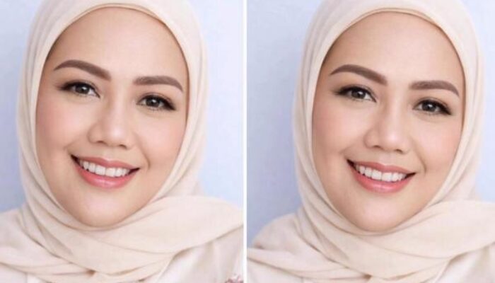 Dihujat karena Fisik Elly Sugigi Rela Oplas Rp65 Juta, Kini Pede Cari Pasangan Ganteng