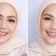 Dihujat karena Fisik Elly Sugigi Rela Oplas Rp65 Juta, Kini Pede Cari Pasangan Ganteng